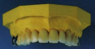 Fixed ceramic bridge