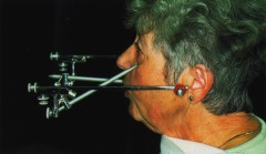 Funktionsdiagnostik